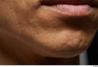  HD Face skin references Chikanari Ryosei lips mouth scar skin pores skin texture 0001.jpg